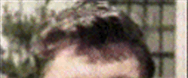Morph Source Photo Forehead area